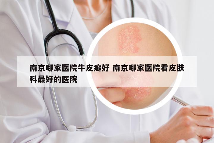 南京哪家医院牛皮癣好 南京哪家医院看皮肤科最好的医院