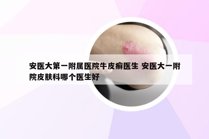 安医大第一附属医院牛皮癣医生 安医大一附院皮肤科哪个医生好