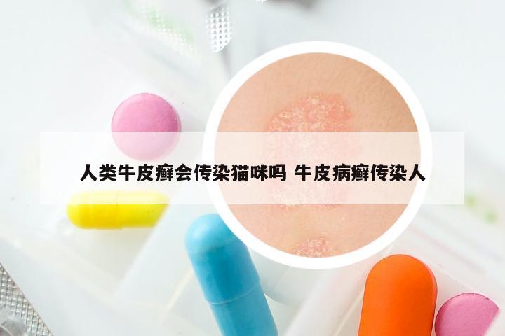 人类牛皮癣会传染猫咪吗 牛皮病癣传染人