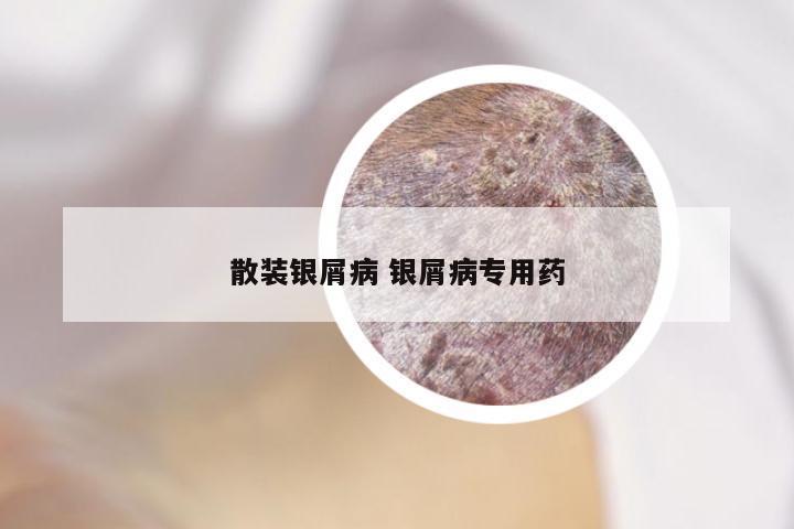 散装银屑病 银屑病专用药