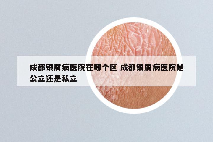 成都银屑病医院在哪个区 成都银屑病医院是公立还是私立