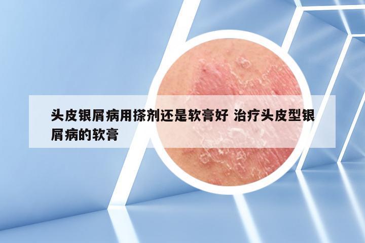 头皮银屑病用搽剂还是软膏好 治疗头皮型银屑病的软膏