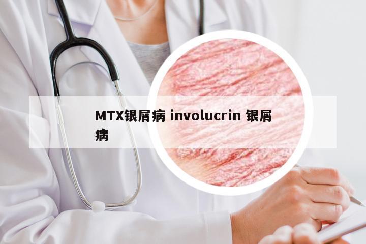 MTX银屑病 involucrin 银屑病