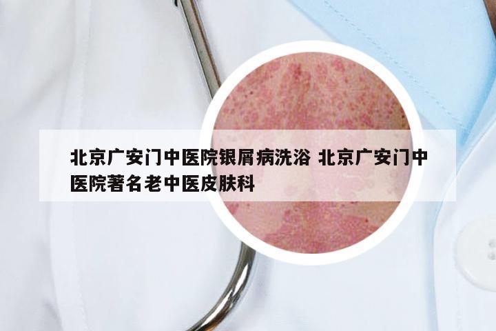 北京广安门中医院银屑病洗浴 北京广安门中医院著名老中医皮肤科