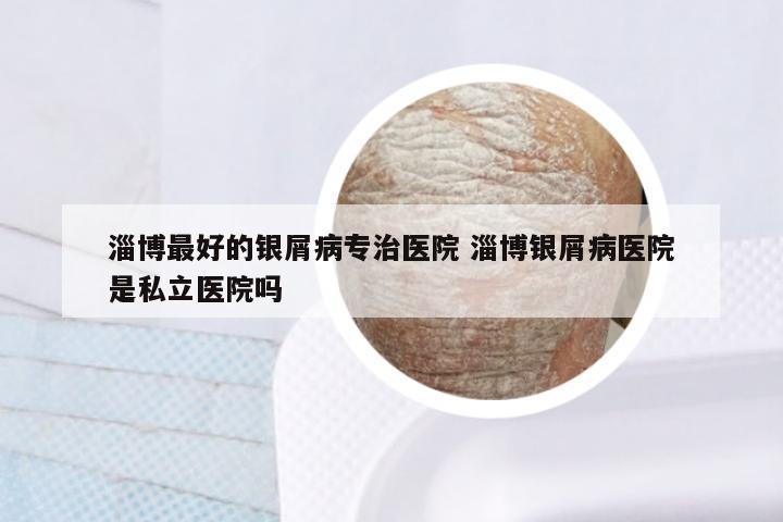 淄博最好的银屑病专治医院 淄博银屑病医院是私立医院吗