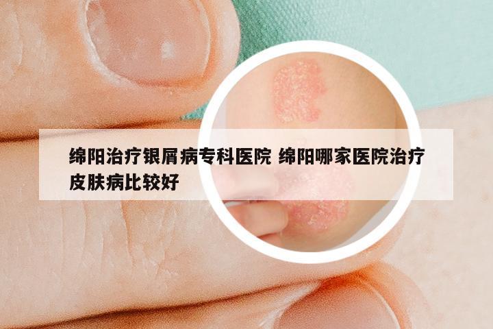 绵阳治疗银屑病专科医院 绵阳哪家医院治疗皮肤病比较好