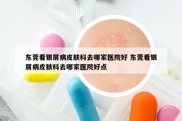 东莞看银屑病皮肤科去哪家医院好 东莞看银屑病皮肤科去哪家医院好点