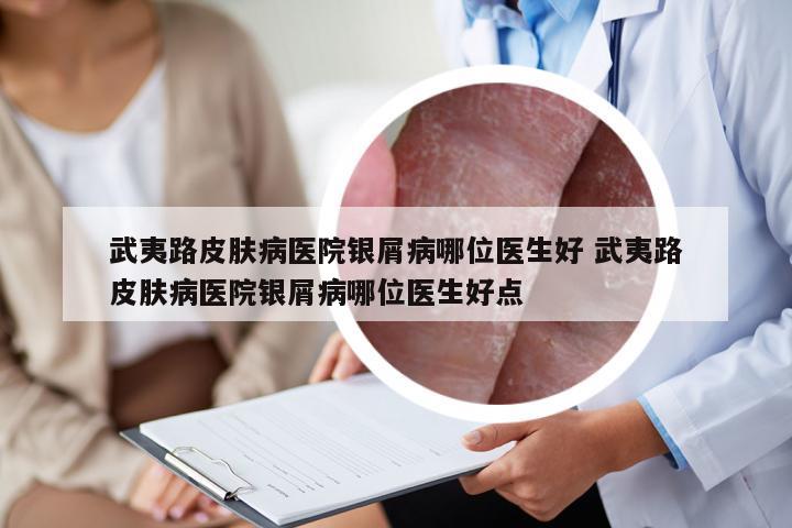 武夷路皮肤病医院银屑病哪位医生好 武夷路皮肤病医院银屑病哪位医生好点