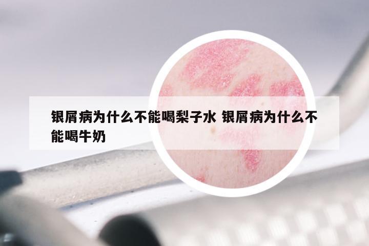 银屑病为什么不能喝梨子水 银屑病为什么不能喝牛奶
