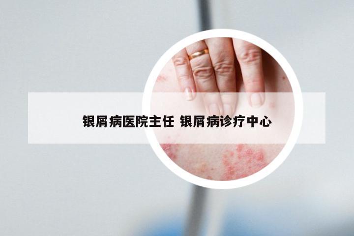 银屑病医院主任 银屑病诊疗中心