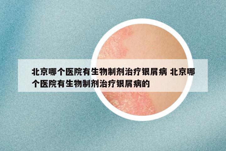 北京哪个医院有生物制剂治疗银屑病 北京哪个医院有生物制剂治疗银屑病的