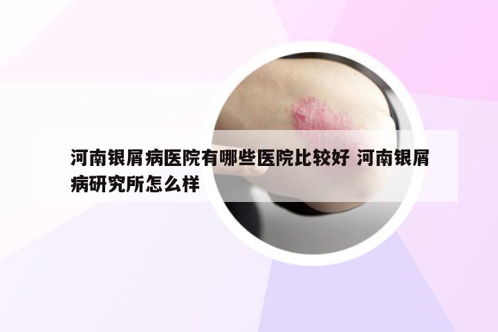 河南银屑病医院有哪些医院比较好 河南银屑病研究所怎么样