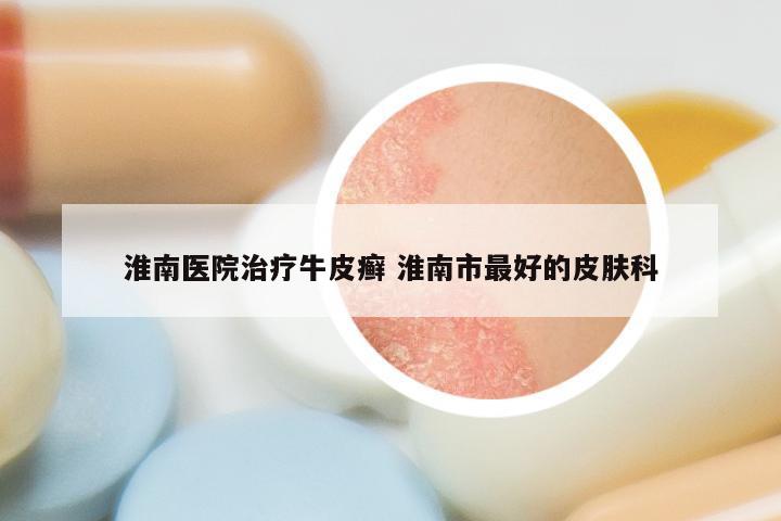 淮南医院治疗牛皮癣 淮南市最好的皮肤科