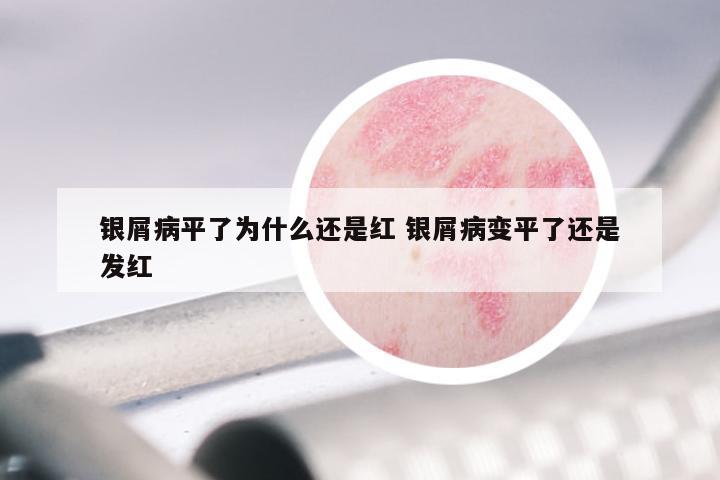 银屑病平了为什么还是红 银屑病变平了还是发红