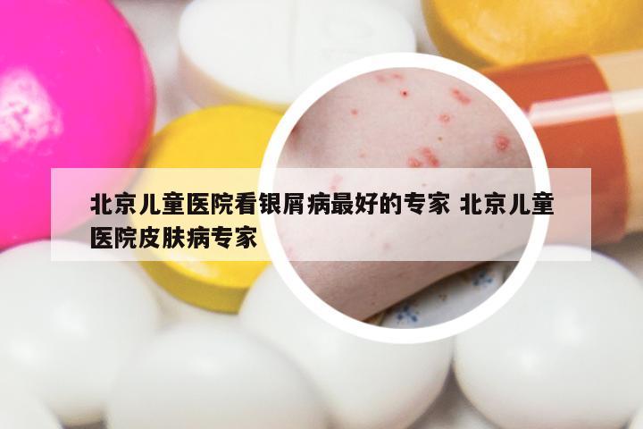 北京儿童医院看银屑病最好的专家 北京儿童医院皮肤病专家