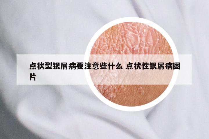 点状型银屑病要注意些什么 点状性银屑病图片