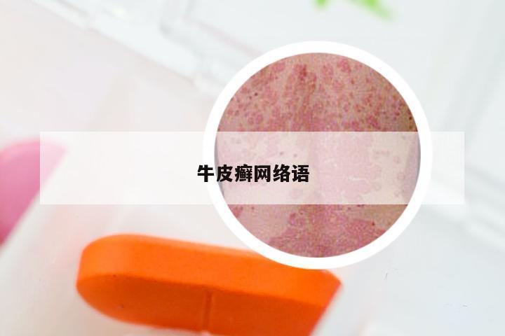 牛皮癣网络语