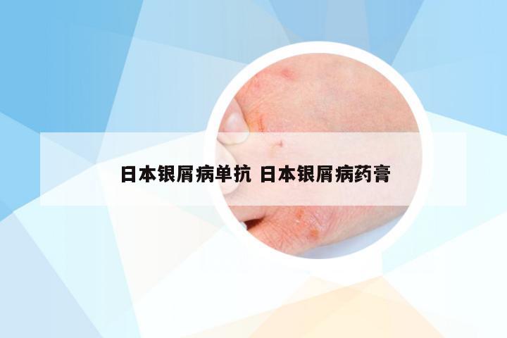 日本银屑病单抗 日本银屑病药膏
