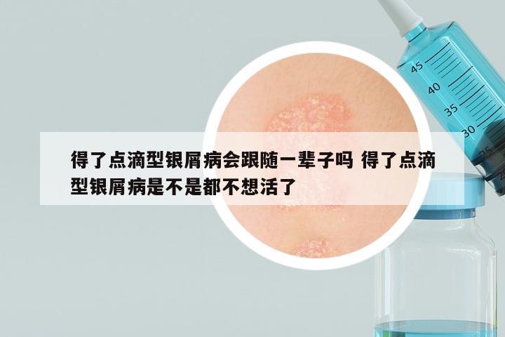 得了点滴型银屑病会跟随一辈子吗 得了点滴型银屑病是不是都不想活了