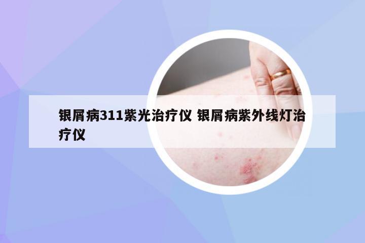 银屑病311紫光治疗仪 银屑病紫外线灯治疗仪