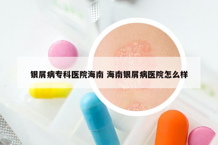 银屑病专科医院海南 海南银屑病医院怎么样