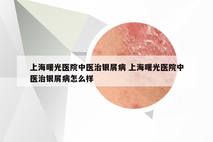 上海曙光医院中医治银屑病 上海曙光医院中医治银屑病怎么样