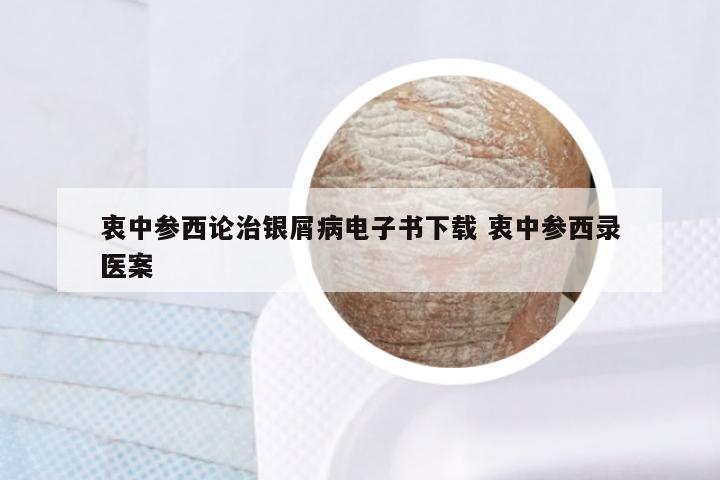 衷中参西论治银屑病电子书下载 衷中参西录医案