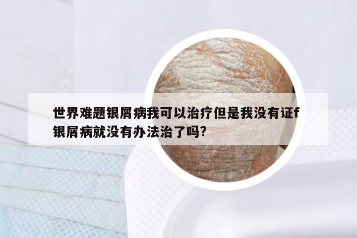 世界难题银屑病我可以治疗但是我没有证f 银屑病就没有办法治了吗?