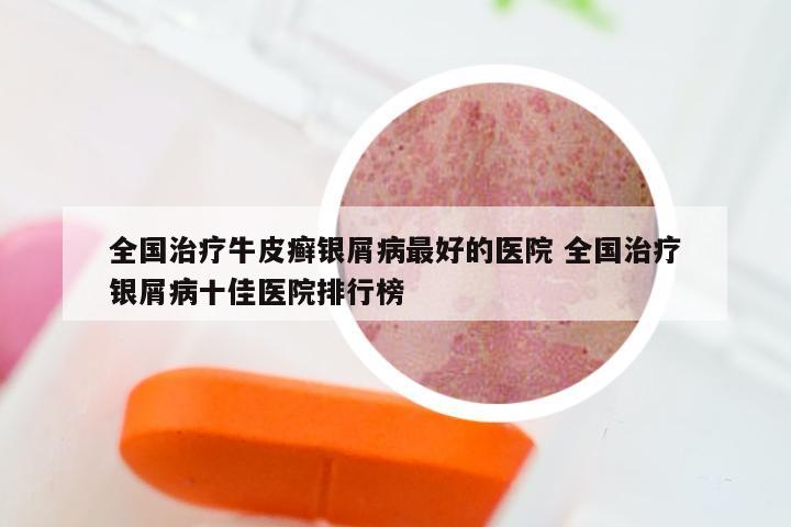 全国治疗牛皮癣银屑病最好的医院 全国治疗银屑病十佳医院排行榜