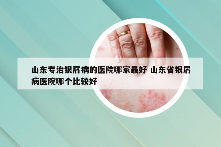 山东专治银屑病的医院哪家最好 山东省银屑病医院哪个比较好