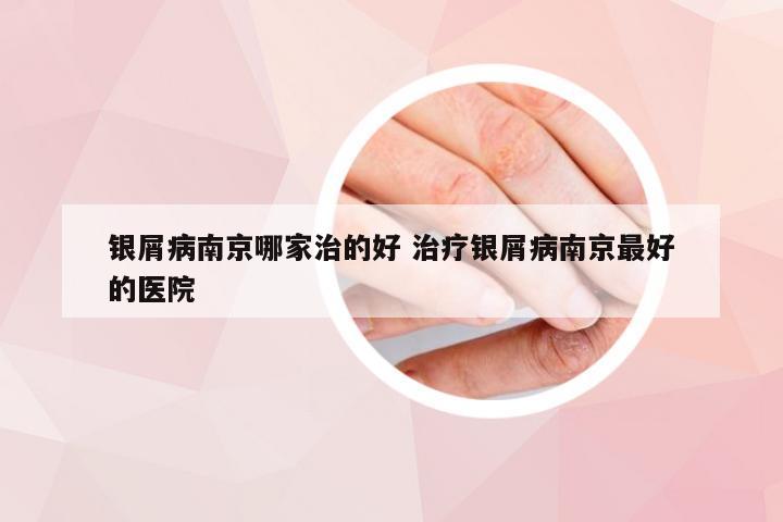 银屑病南京哪家治的好 治疗银屑病南京最好的医院