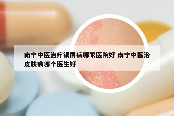南宁中医治疗银屑病哪家医院好 南宁中医治皮肤病哪个医生好