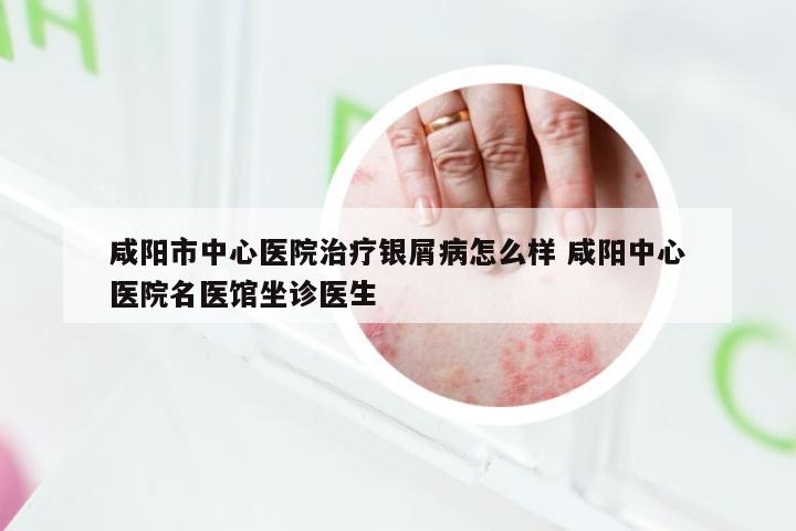 咸阳市中心医院治疗银屑病怎么样 咸阳中心医院名医馆坐诊医生