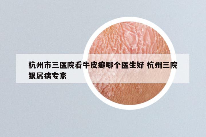 杭州市三医院看牛皮癣哪个医生好 杭州三院银屑病专家