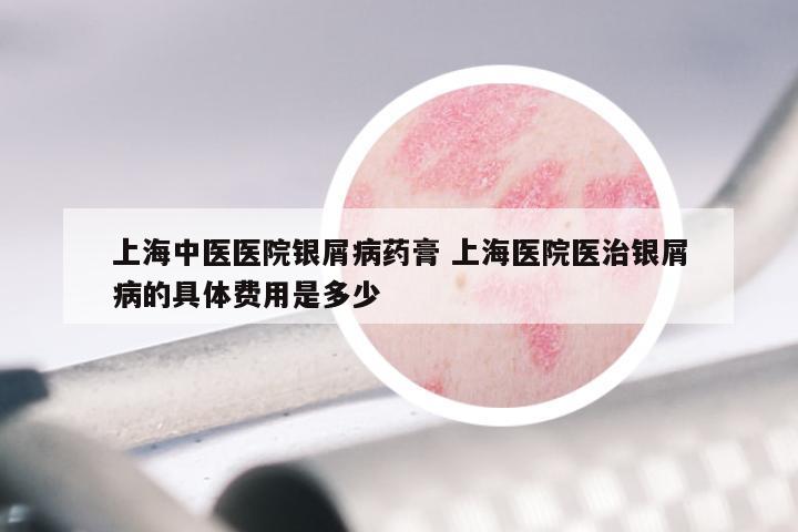 上海中医医院银屑病药膏 上海医院医治银屑病的具体费用是多少
