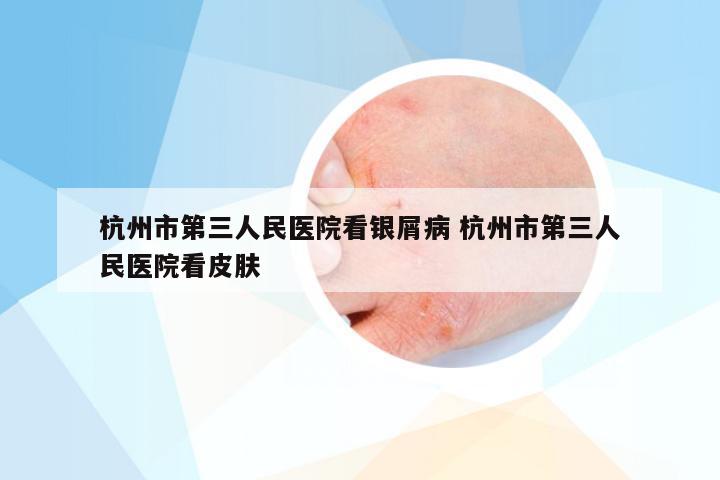 杭州市第三人民医院看银屑病 杭州市第三人民医院看皮肤