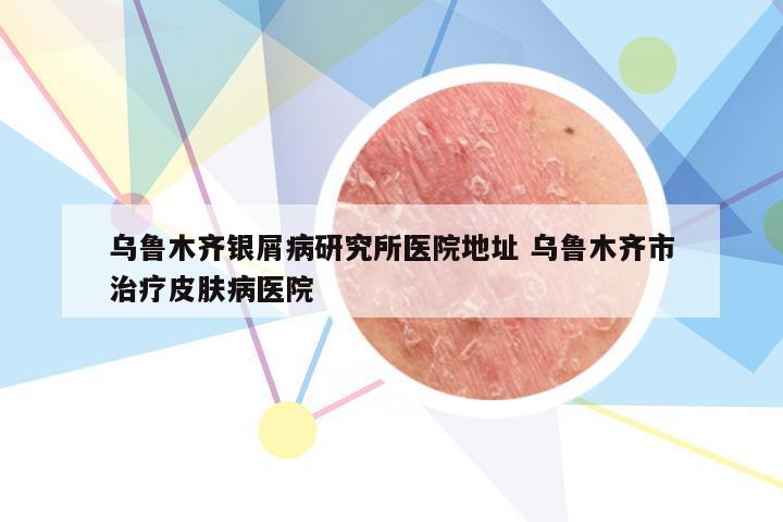 乌鲁木齐银屑病研究所医院地址 乌鲁木齐市治疗皮肤病医院