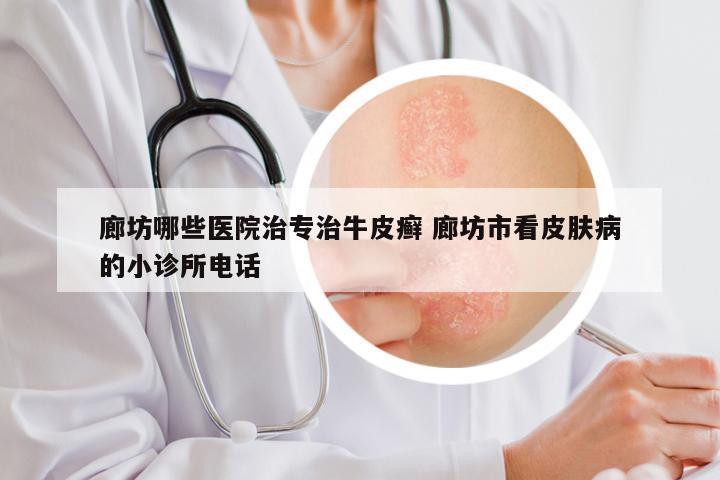 廊坊哪些医院治专治牛皮癣 廊坊市看皮肤病的小诊所电话