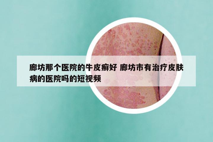 廊坊那个医院的牛皮癣好 廊坊市有治疗皮肤病的医院吗的短视频
