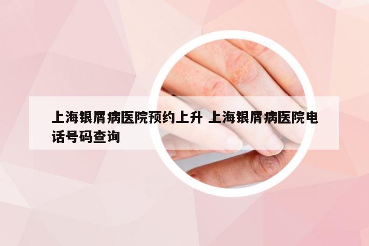 上海银屑病医院预约上升 上海银屑病医院电话号码查询