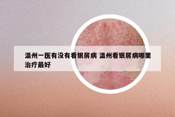 温州一医有没有看银屑病 温州看银屑病哪里治疗最好