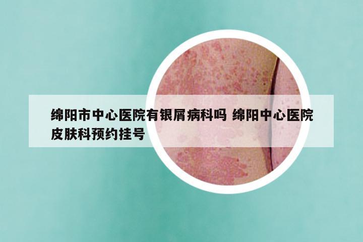绵阳市中心医院有银屑病科吗 绵阳中心医院皮肤科预约挂号