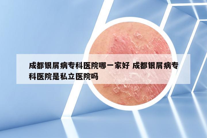 成都银屑病专科医院哪一家好 成都银屑病专科医院是私立医院吗