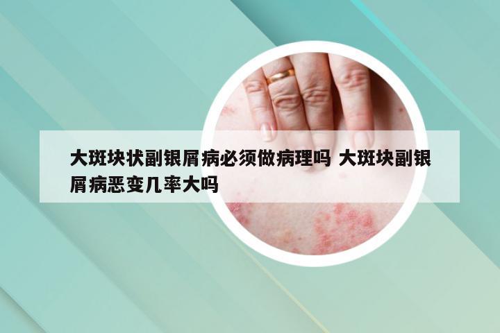 大斑块状副银屑病必须做病理吗 大斑块副银屑病恶变几率大吗