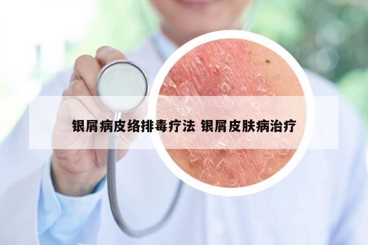 银屑病皮络排毒疗法 银屑皮肤病治疗