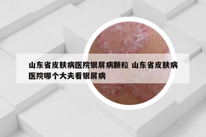 山东省皮肤病医院银屑病颗粒 山东省皮肤病医院哪个大夫看银屑病