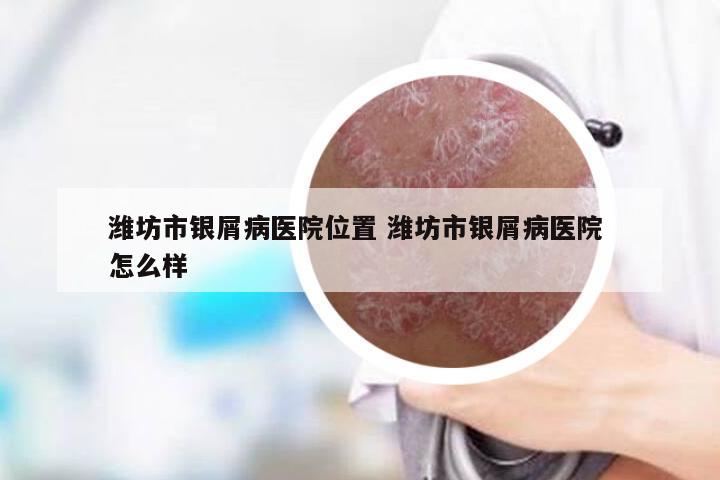 潍坊市银屑病医院位置 潍坊市银屑病医院 怎么样