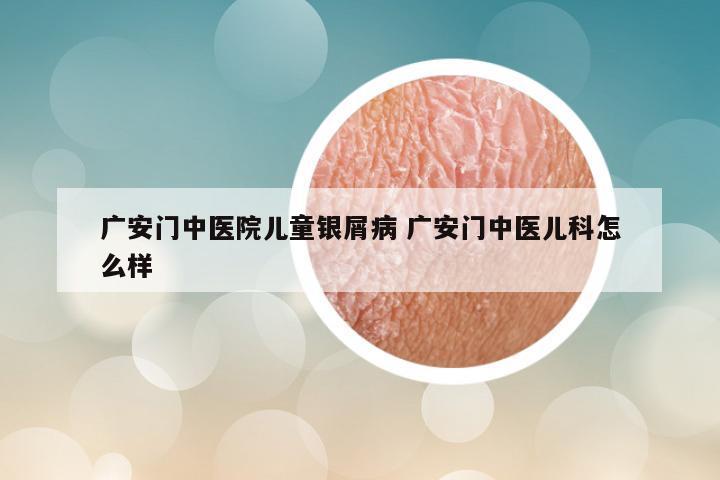 广安门中医院儿童银屑病 广安门中医儿科怎么样