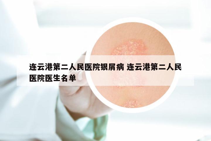 连云港第二人民医院银屑病 连云港第二人民医院医生名单