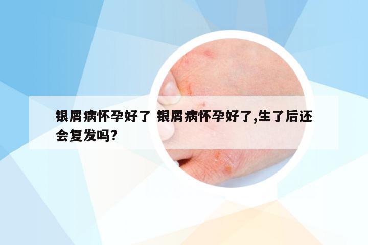 银屑病怀孕好了 银屑病怀孕好了,生了后还会复发吗?